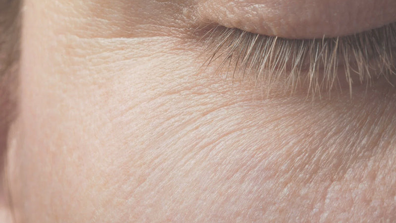 Smoothing Skin Texture - Harben House