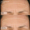 SENTÉ Dermal Repair Cream fine lines before and after 2 weeks