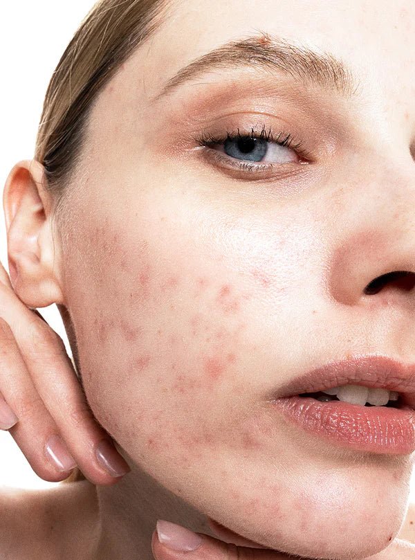 Allies of Skin Azelaic & Kojic Advanced Clarifying Serum - Harben House - Allies of Skin