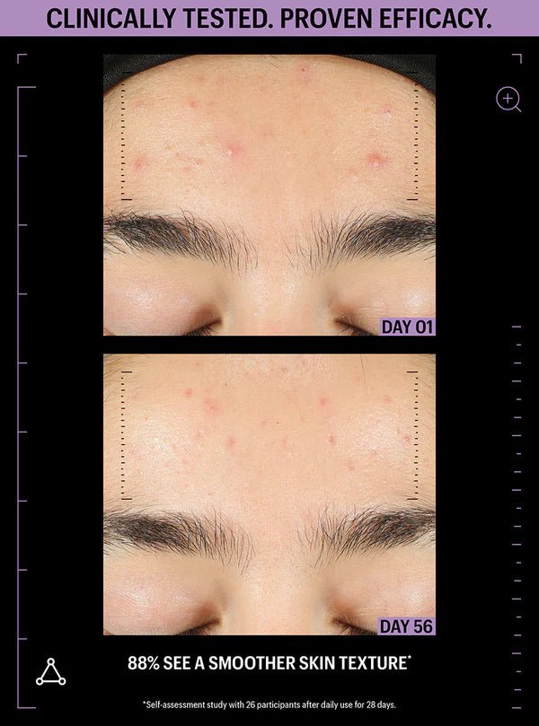 Allies of Skin Azelaic & Kojic Advanced Clarifying Serum - Harben House - Allies of Skin