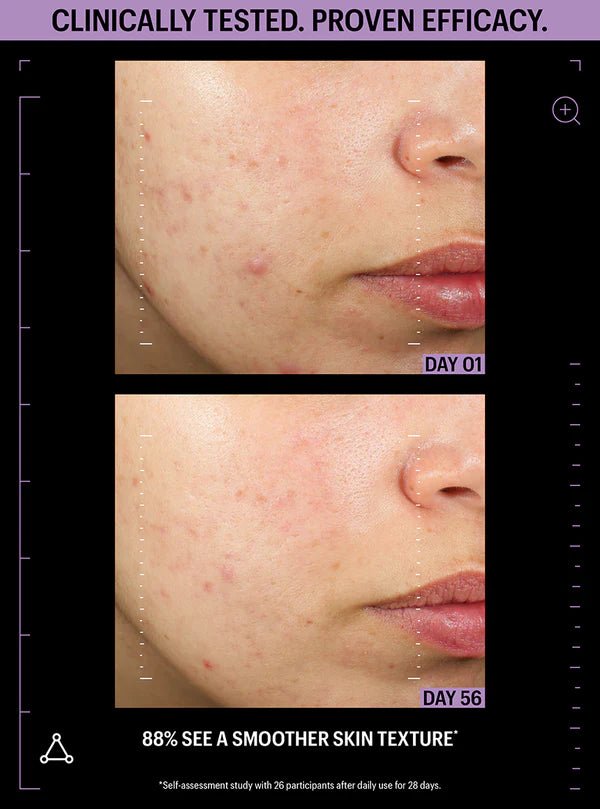 Allies of Skin Azelaic & Kojic Advanced Clarifying Serum - Harben House - Allies of Skin