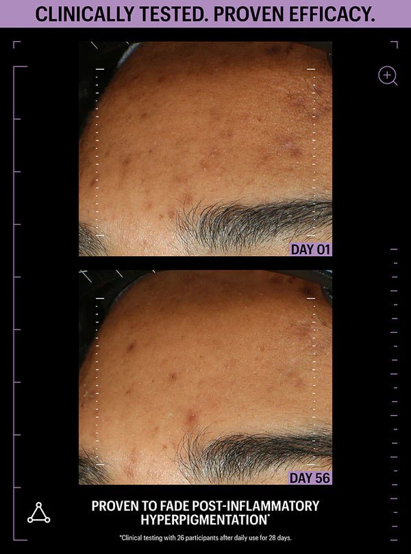 Allies of Skin Azelaic & Kojic Advanced Clarifying Serum - Harben House - Allies of Skin