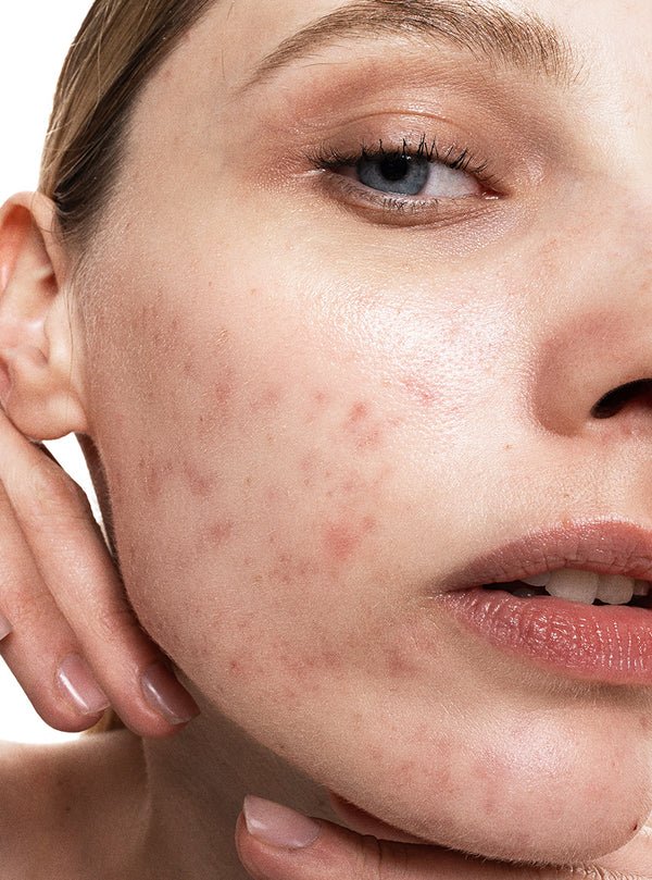 Allies of Skin Promise Keeper Nightly Blemish Treatment - Harben House - Allies of Skin