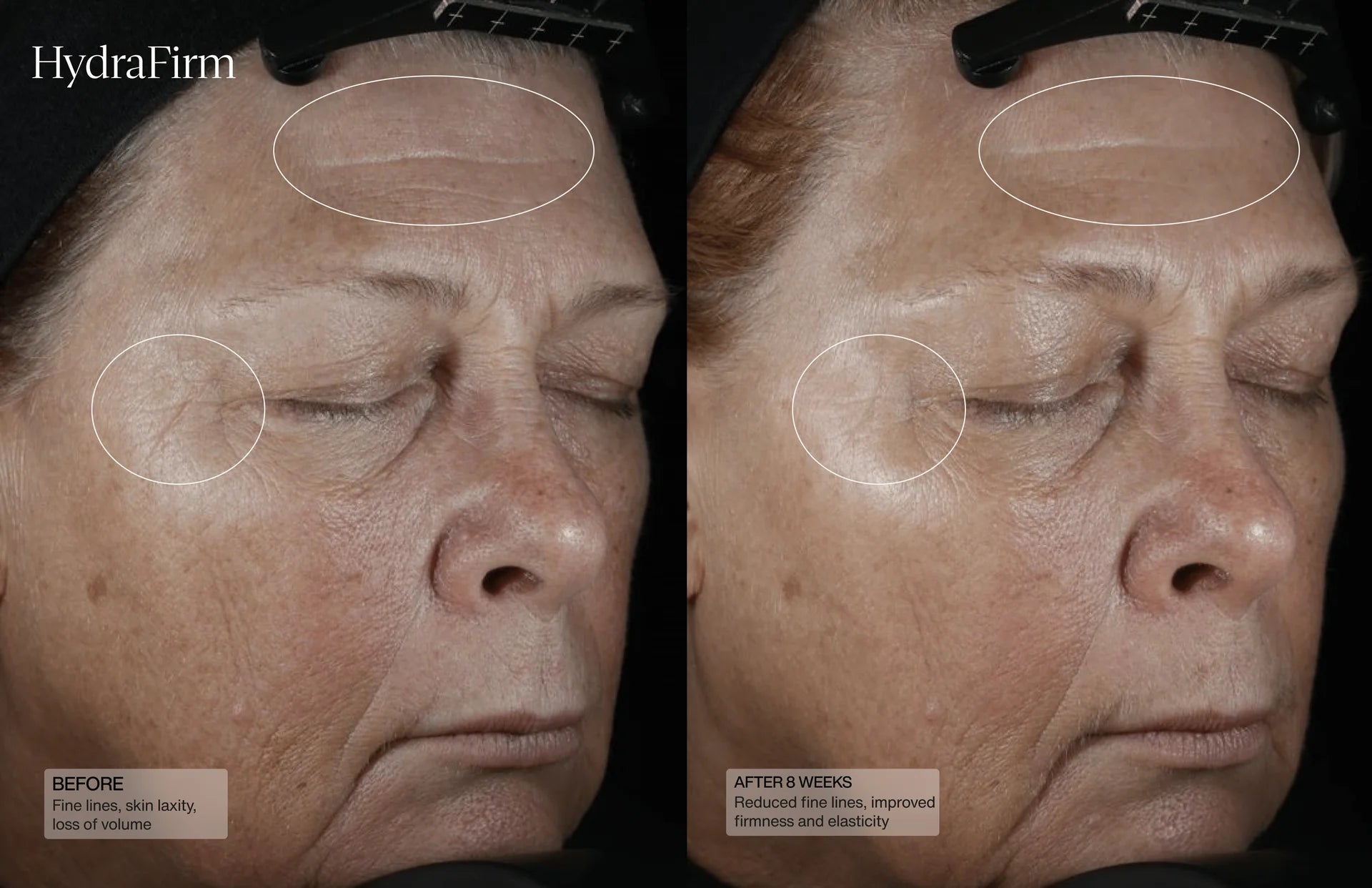 Senté HydraFirm Serum (formerly Dermal Contour Pressed Serum)