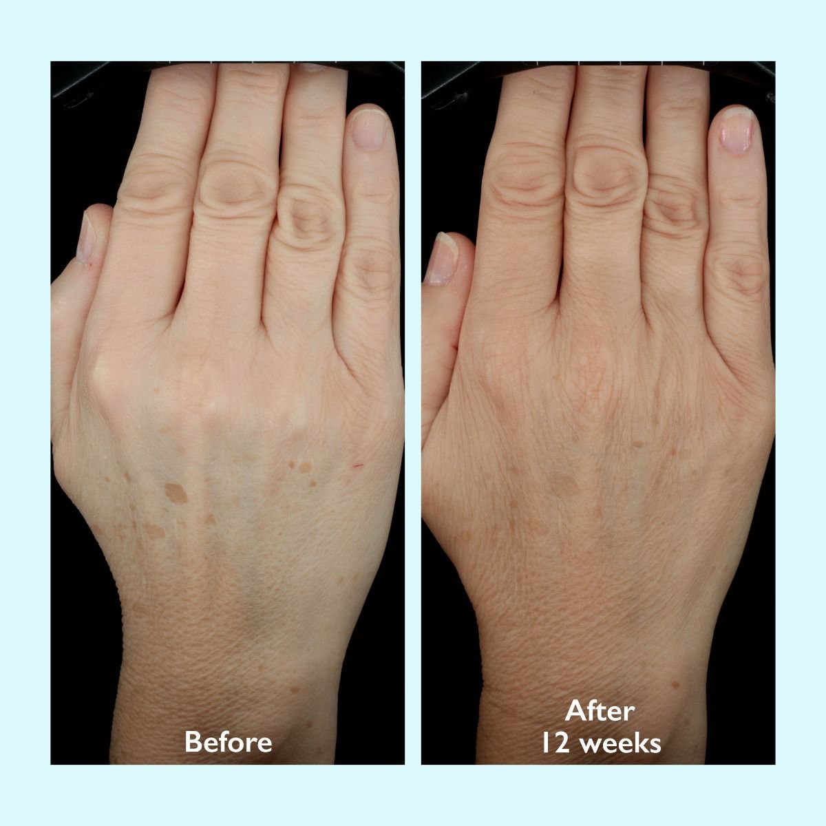 Restorsea PRO Intensive Treatment 10X - Hand Cream - Harben House - Restorsea PRO