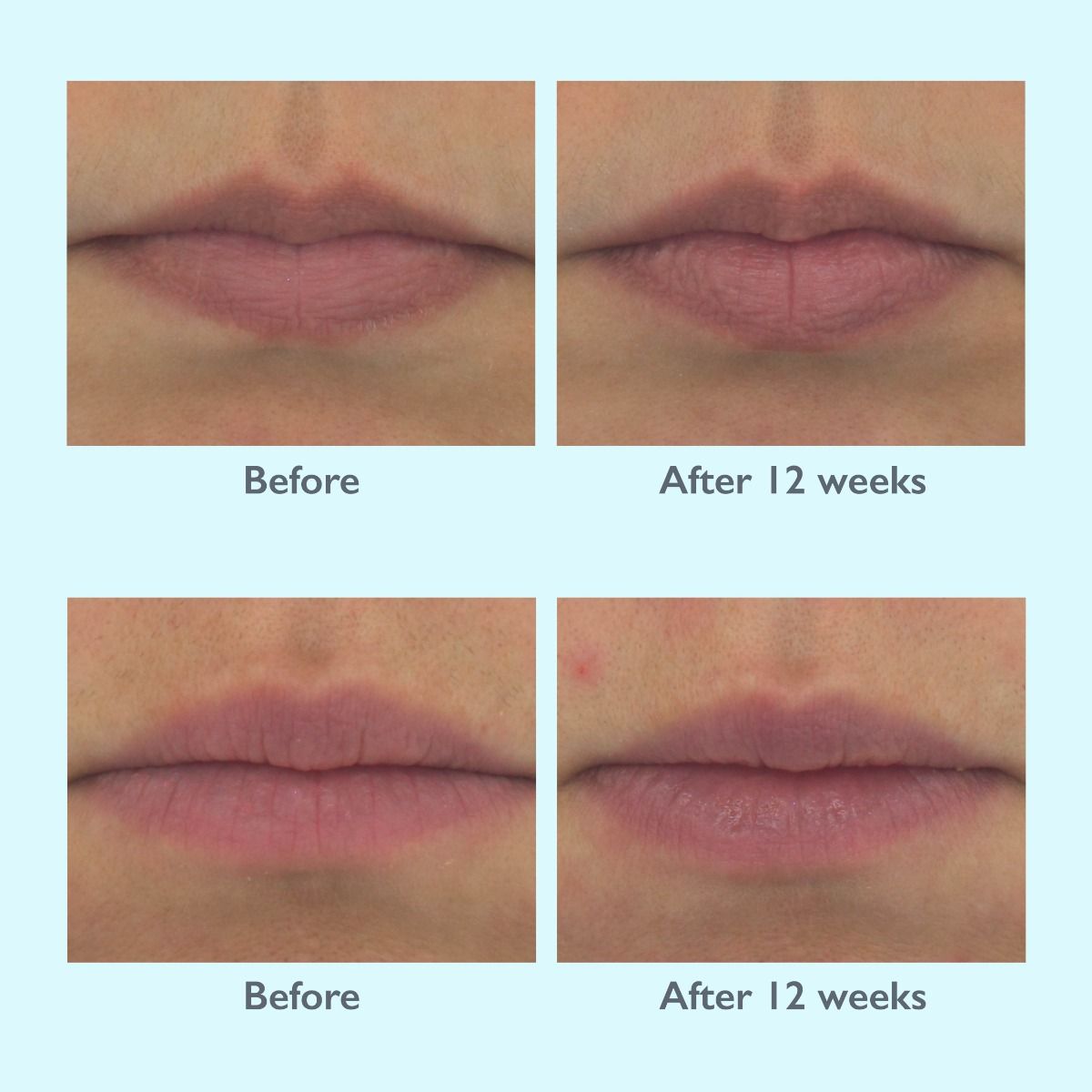 Restorsea PRO Lip Magic - Harben House - Restorsea PRO