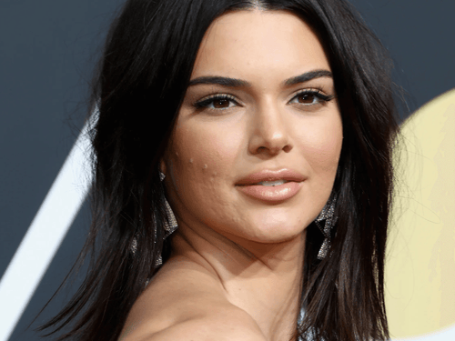 Respond like a Celeb • How Kendall Jenner Deals With Breakouts After A Big Event - Harben House