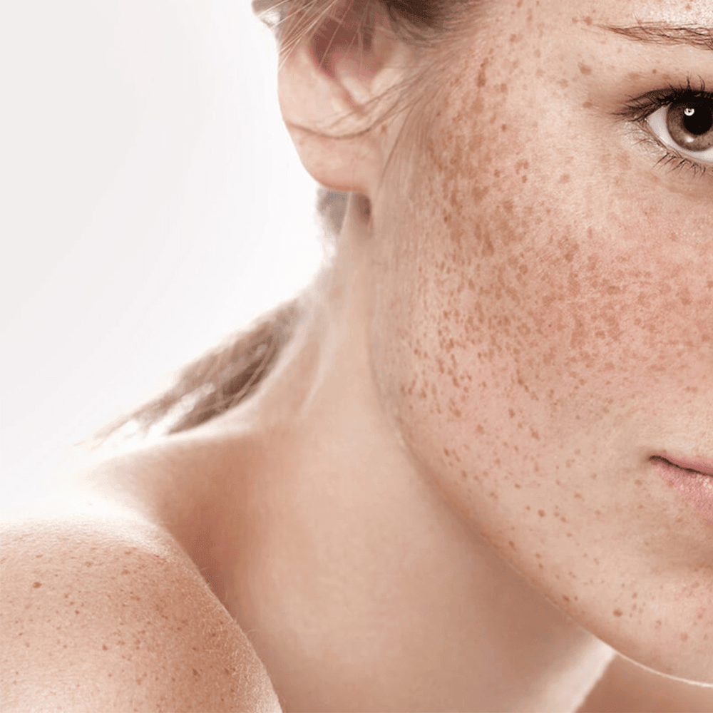 Pigmentation Repair | Skincare - Harben House