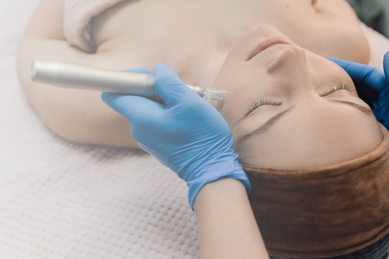 Closeup with a woman laying down with her eyes closed, receiving a microneedling treatment