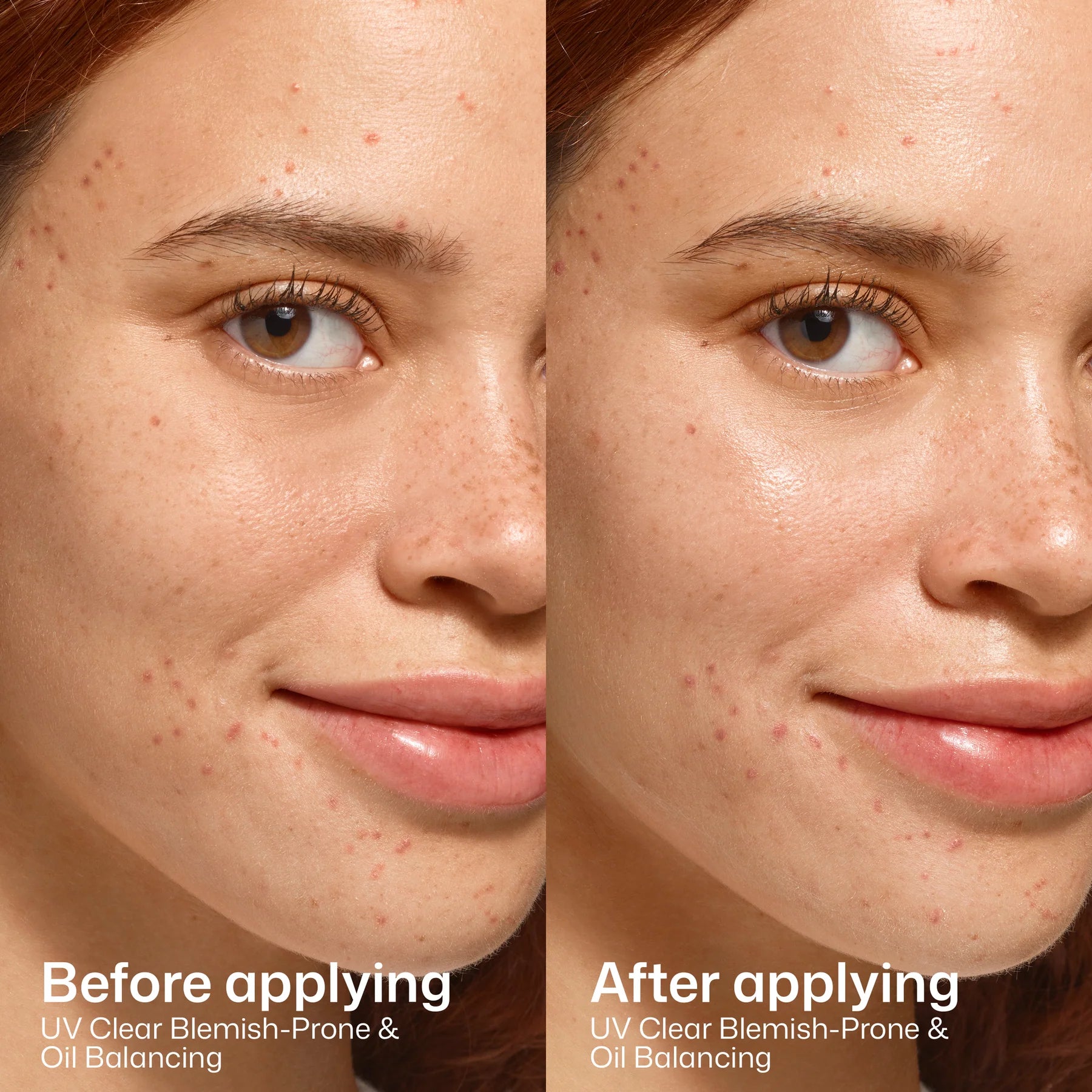 EltaMD UV Clear Blemish-Prone & Oil Balancing SPF 50