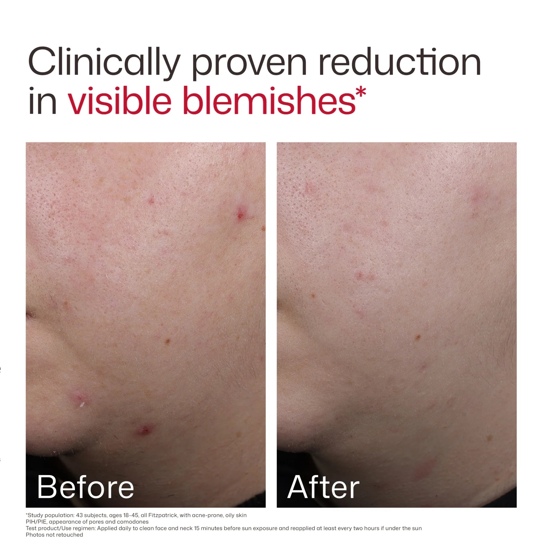 EltaMD UV Clear Blemish-Prone & Oil Balancing SPF 50