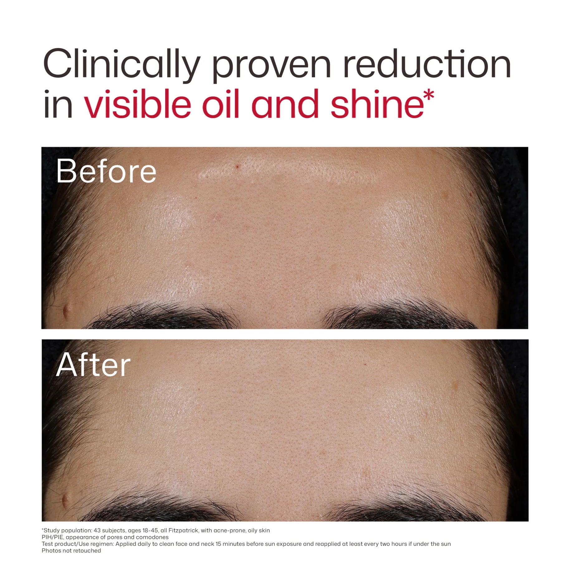 EltaMD UV Clear Blemish-Prone & Oil Balancing SPF 50