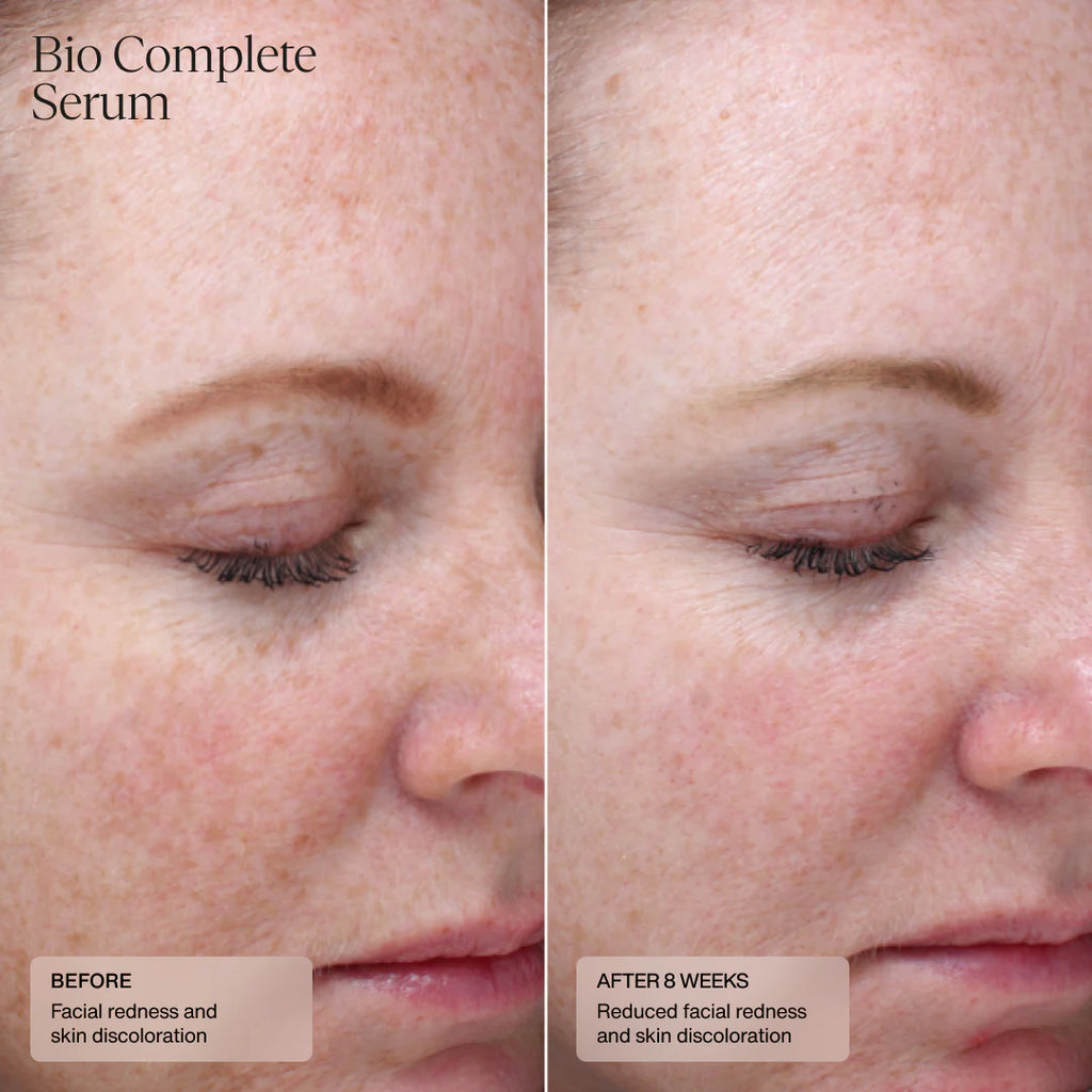 SENTÉ Bio Complete Serum Before and After
