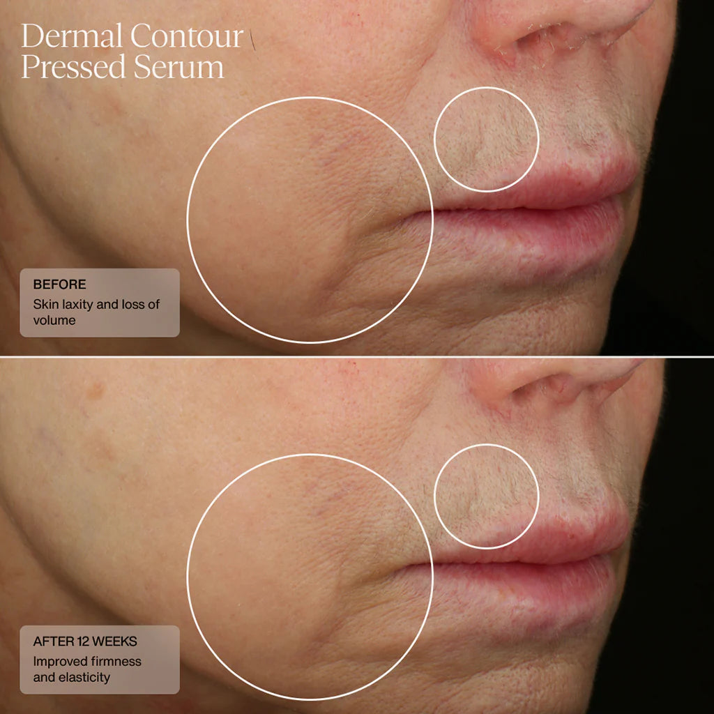 SENTÉ Dermal Contour Pressed Serum Before and After