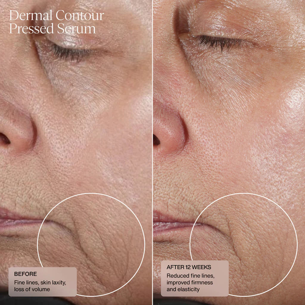 SENTÉ Dermal Contour Pressed Serum Before And After 12 weeks