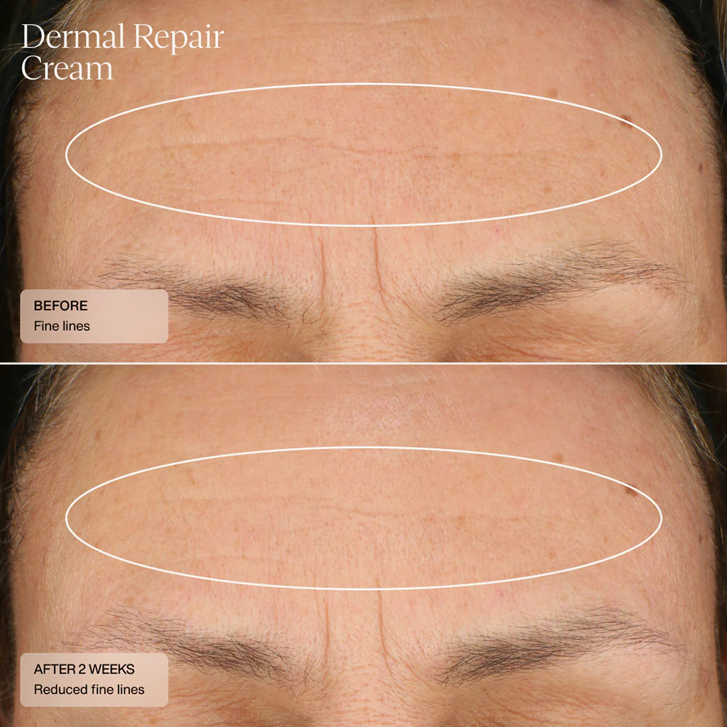 SENTÉ Dermal Repair Cream fine lines before and after 2 weeks