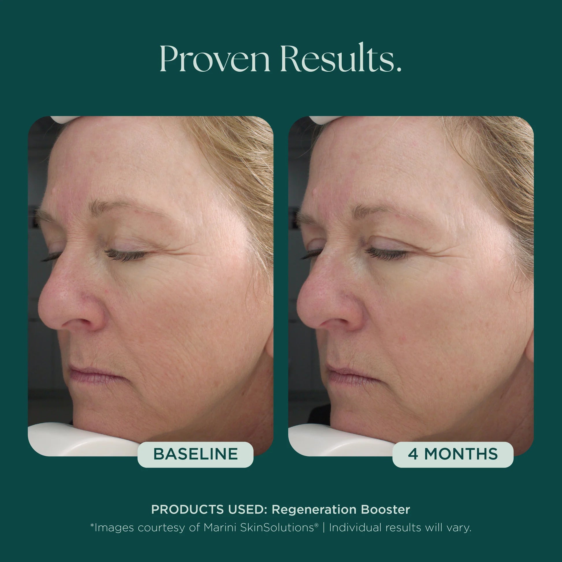 Marini Skin Solutions Regeneration Booster