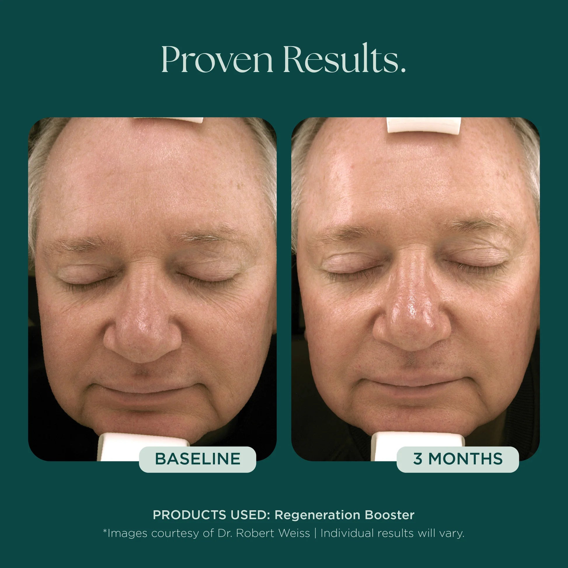 Marini Skin Solutions Regeneration Booster