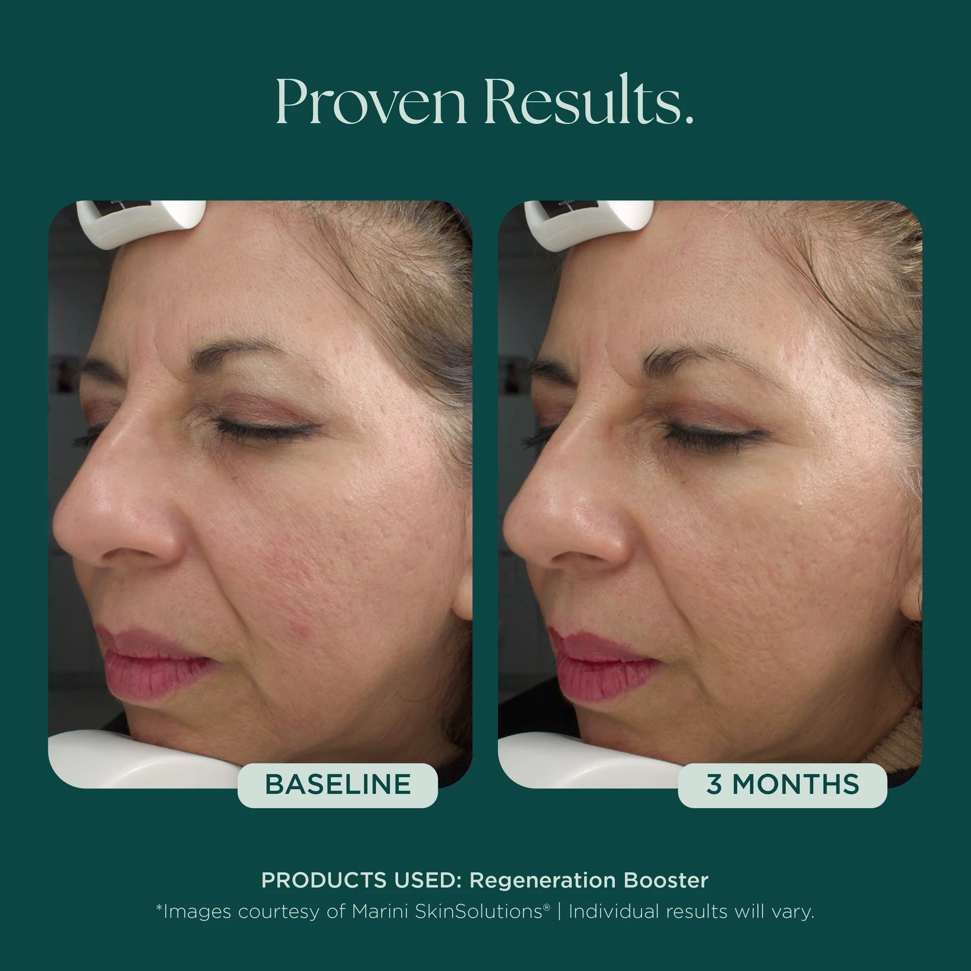 Marini Skin Solutions Regeneration Booster