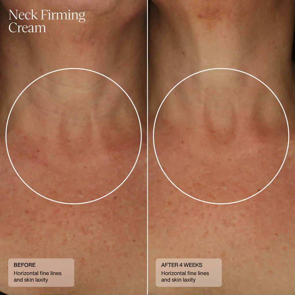 SENTÉ Neck Firming Cream Before and After 4 Weeks