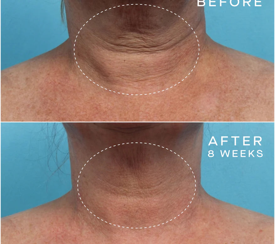 Ourself Advanced Regenerative Serum
