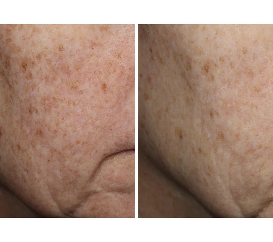 Ourself Complexion Brightening Serum