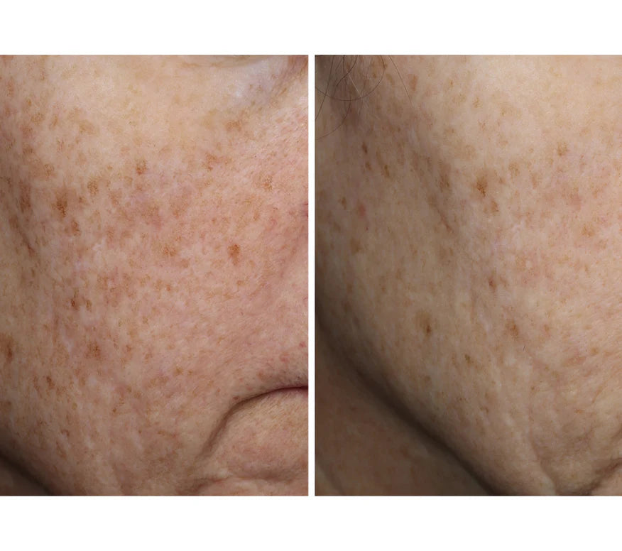 Ourself Complexion Brightening Serum