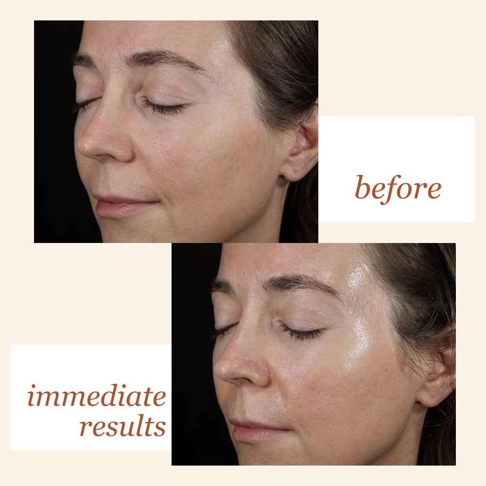 SkinMedica HA⁵® Hydra Collagen Water Burst Moisturizer