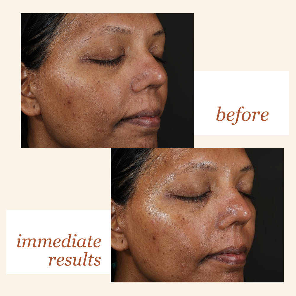 SkinMedica HA⁵® Hydra Collagen Water Burst Moisturizer