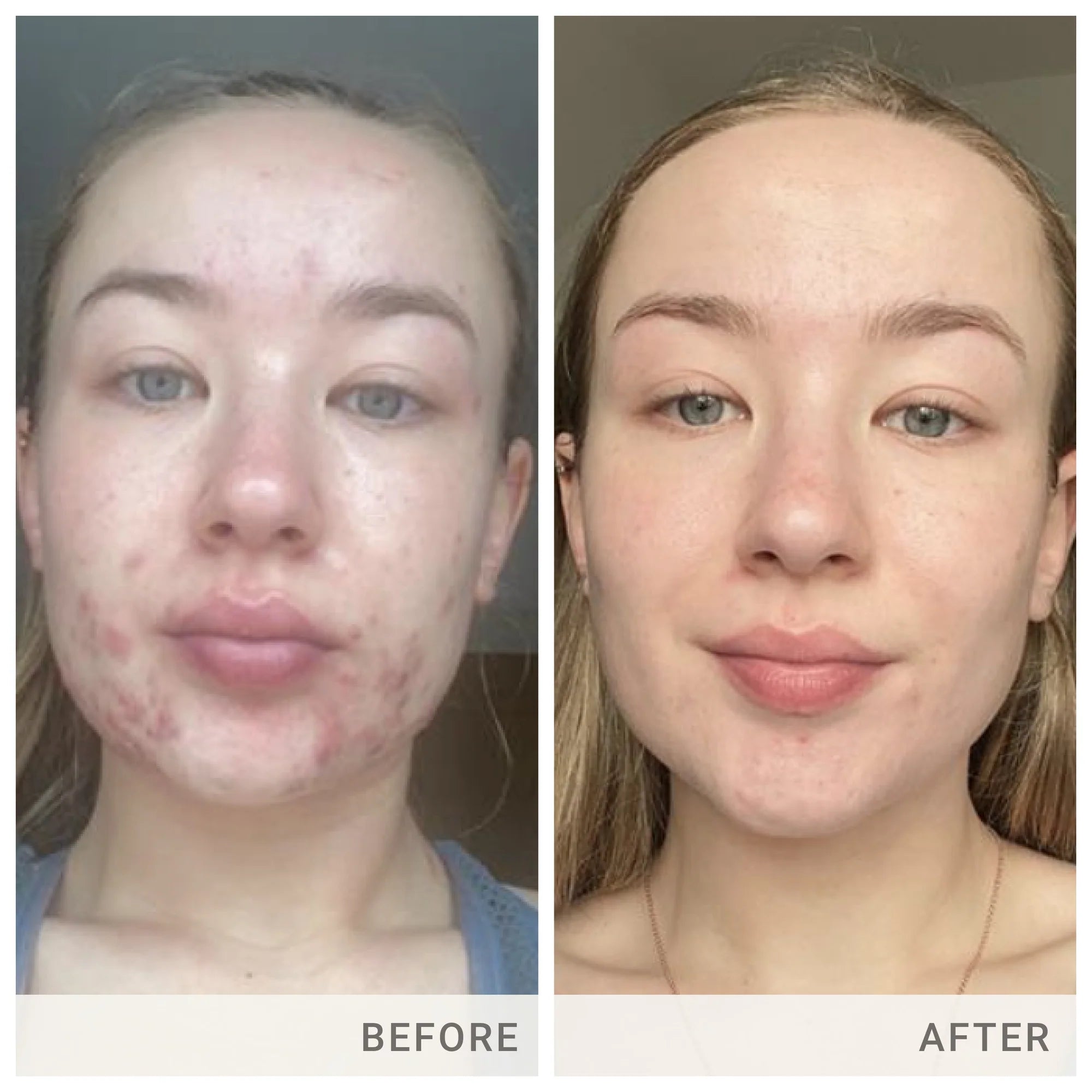 jane iredale Skin Accumax Supplements