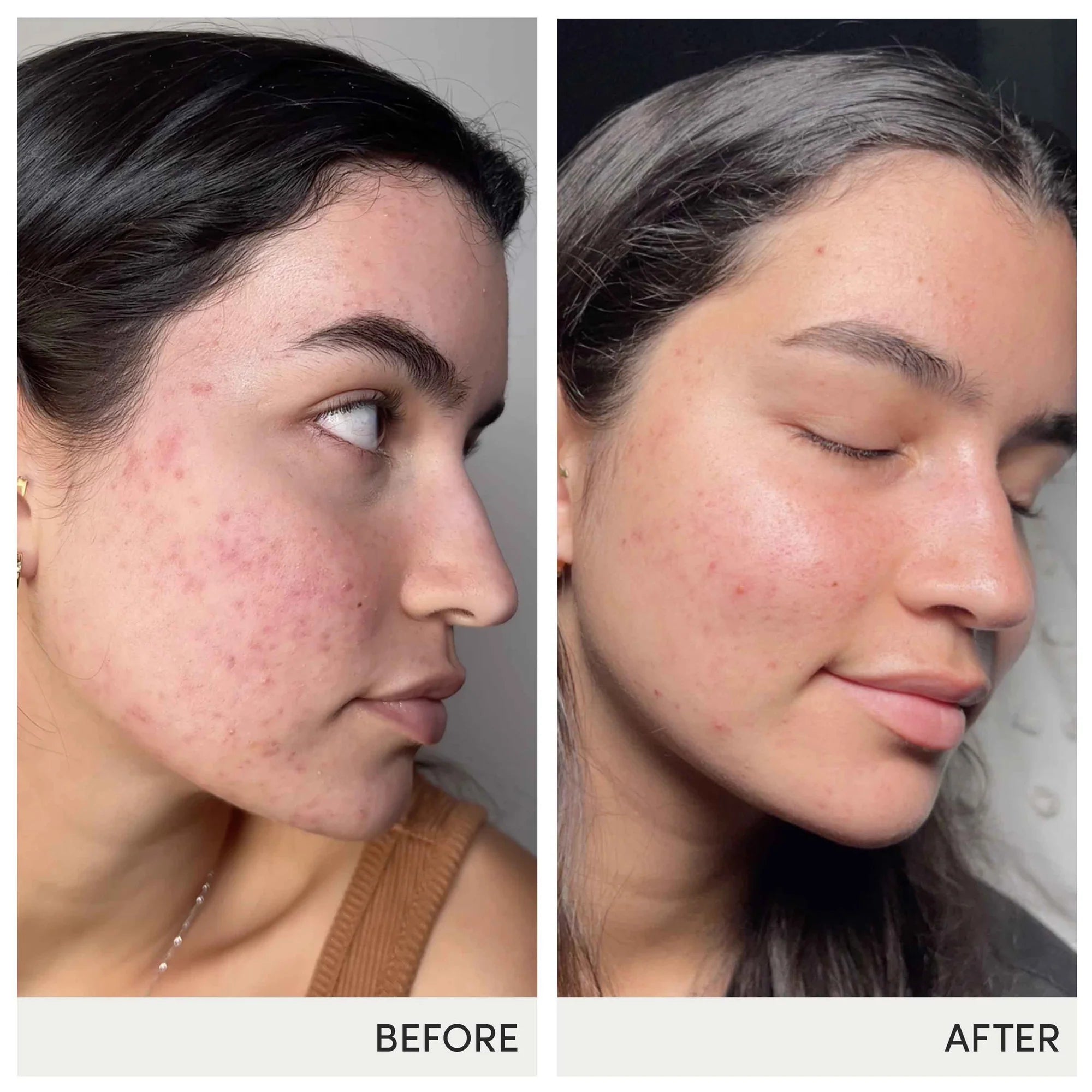 jane iredale Skin Accumax Supplements