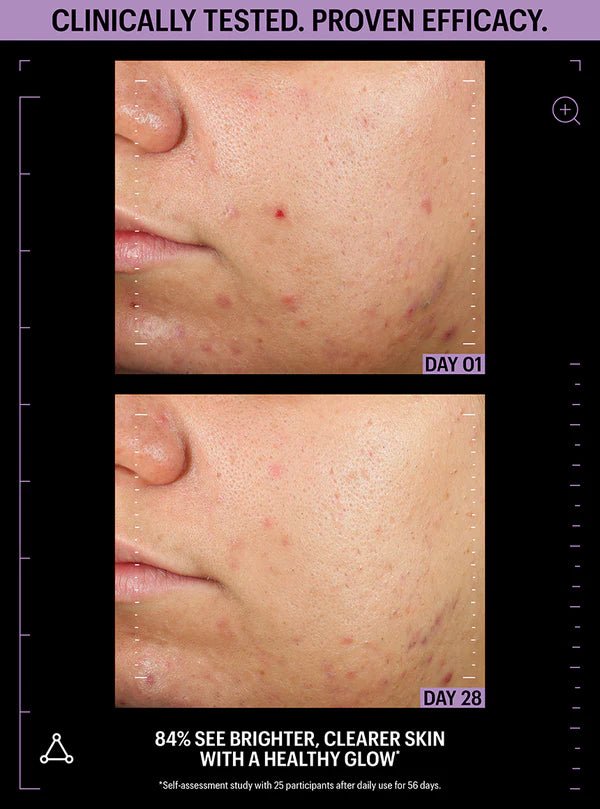 Allies of Skin Azelaic & Kojic Advanced Clarifying Serum - Harben House - Allies of Skin