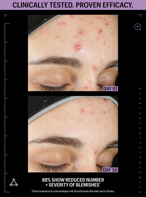 Allies of Skin Azelaic & Kojic Advanced Clarifying Serum - Harben House - Allies of Skin