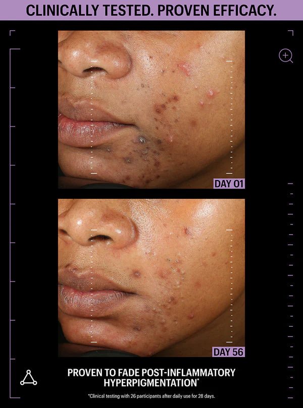 Allies of Skin Azelaic & Kojic Advanced Clarifying Serum - Harben House - Allies of Skin