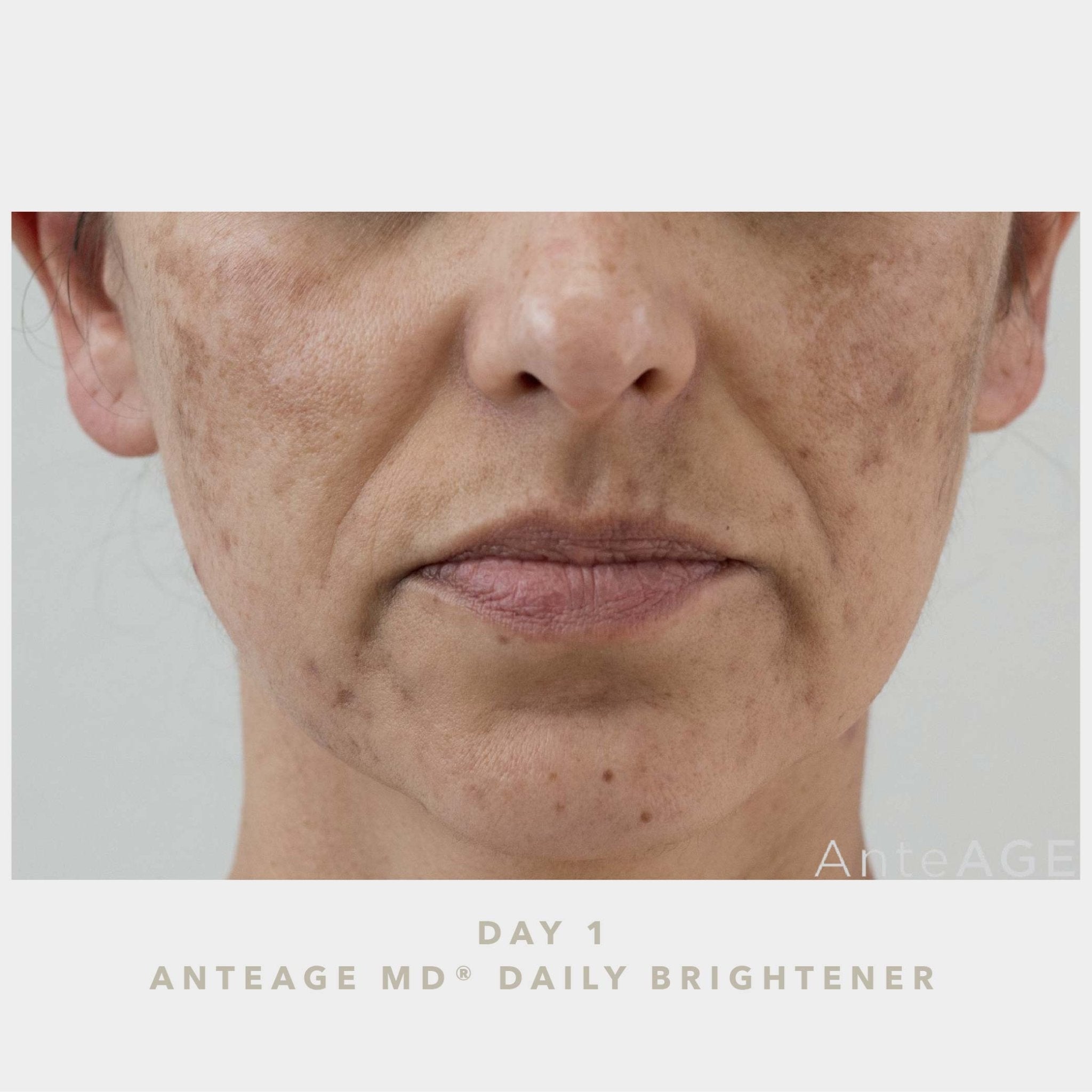 AnteAGE MD Brightener - Harben House - AnteAGE MD