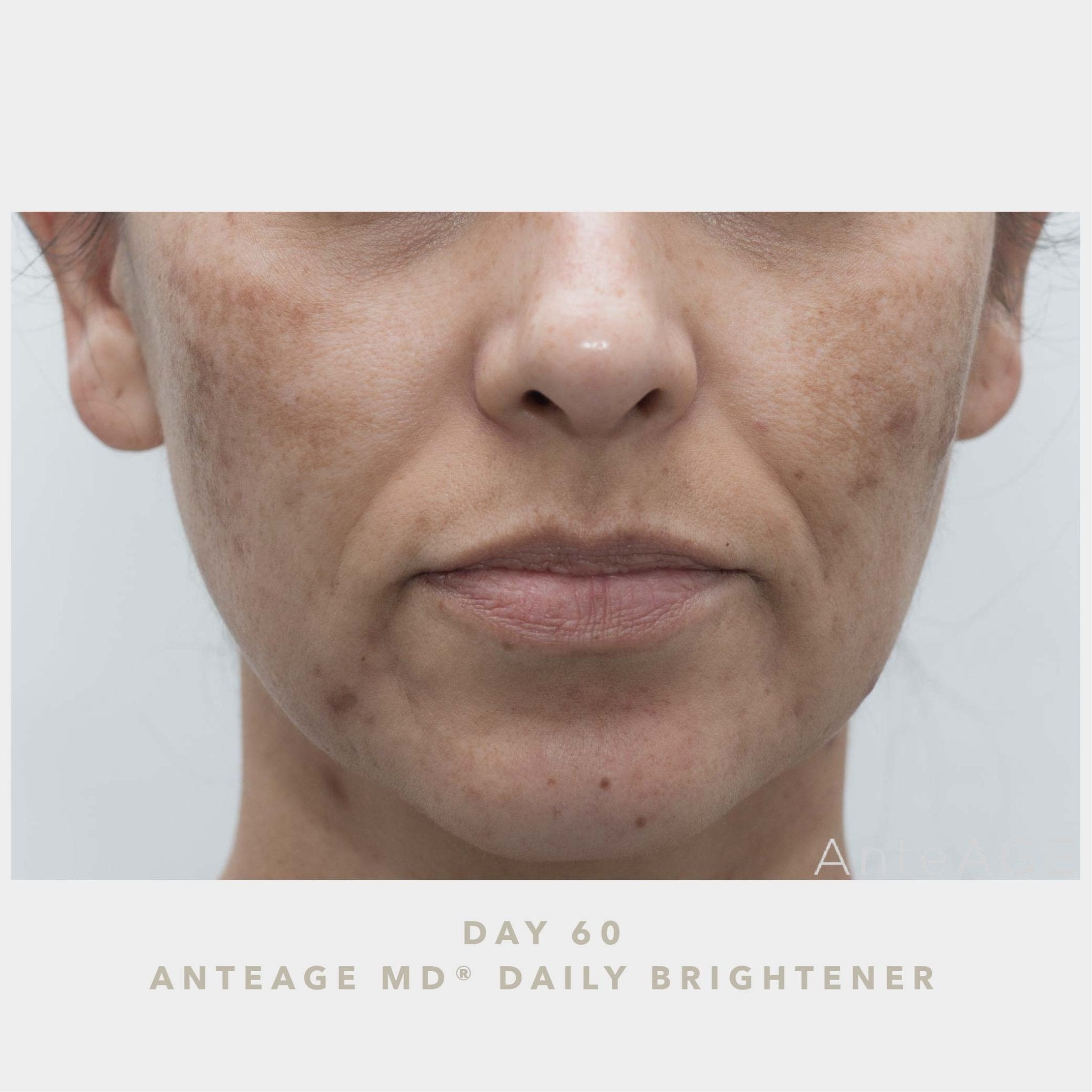 AnteAGE MD Brightener - Harben House - AnteAGE MD