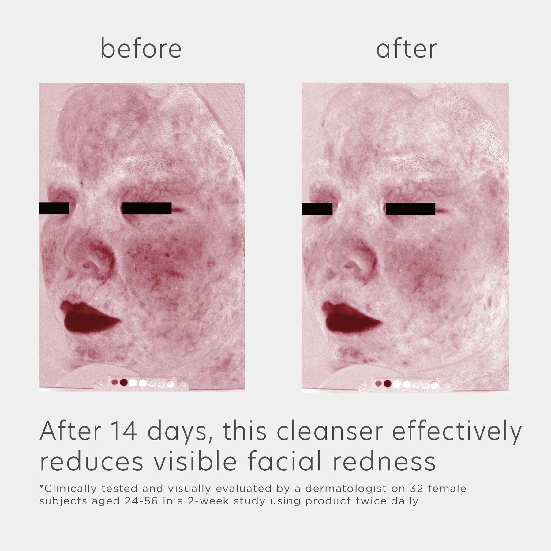 EltaMD Skin Recovery Amino Acid Foaming Cleanser - Harben House - EltaMD