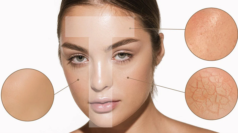 Closeup on a young woman's face, highlighting oily skin along the T-zone and dry cheeks.