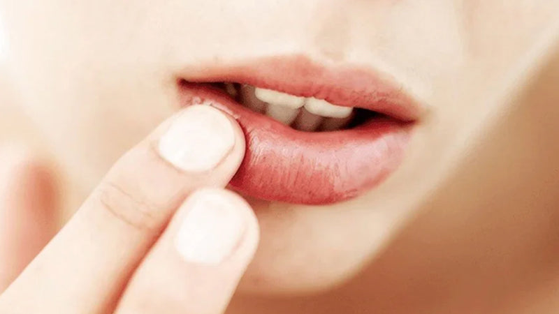 Closeup on a person lightly touching their chapped lips