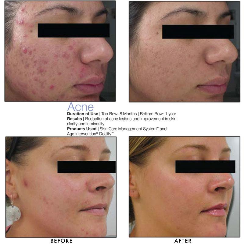 Jan Marini Age Intervention Duality MD | Shop HARBEN HOUSE