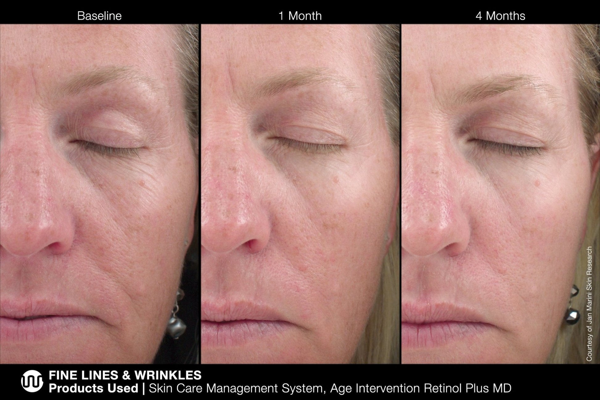 Jan Marini Age Intervention Retinol Plus MD - Harben House - Jan Marini