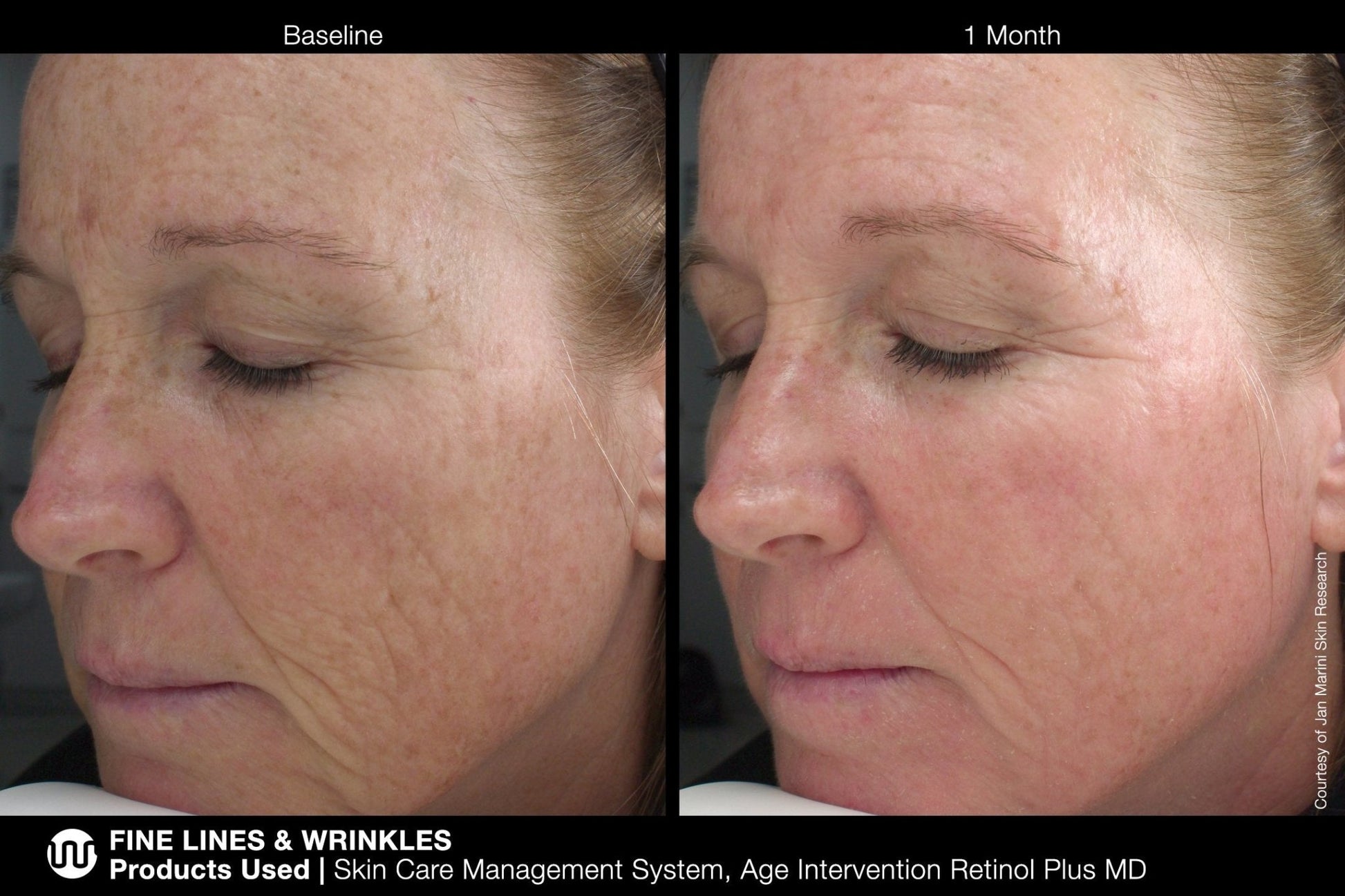 Jan Marini Age Intervention Retinol Plus MD - Harben House - Jan Marini