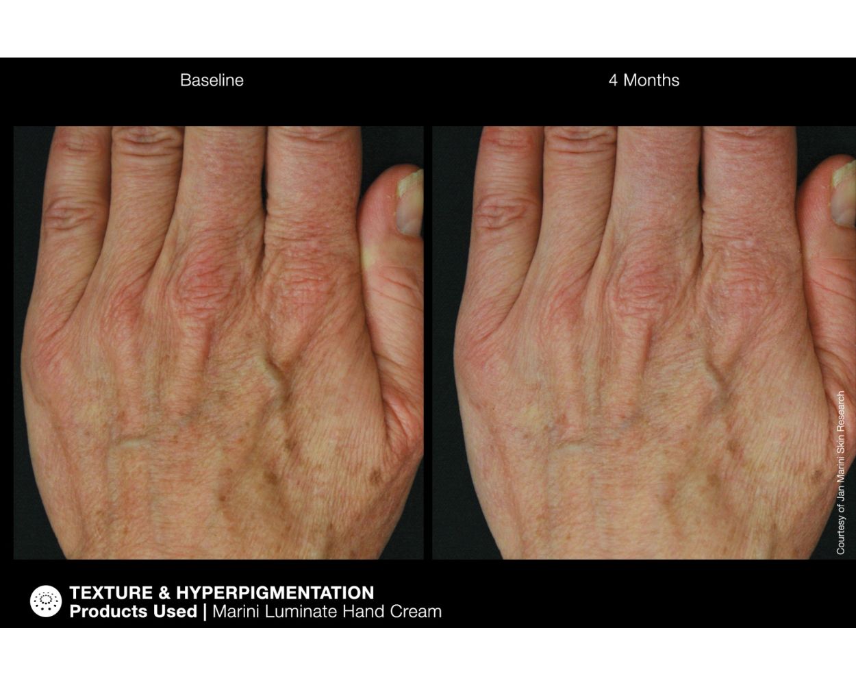 Jan Marini Marini ReNu Corrective Hand Complex - Harben House - Jan Marini