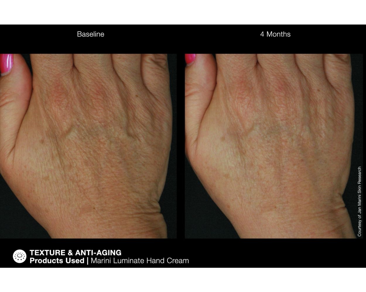 Jan Marini Marini ReNu Corrective Hand Complex - Harben House - Jan Marini