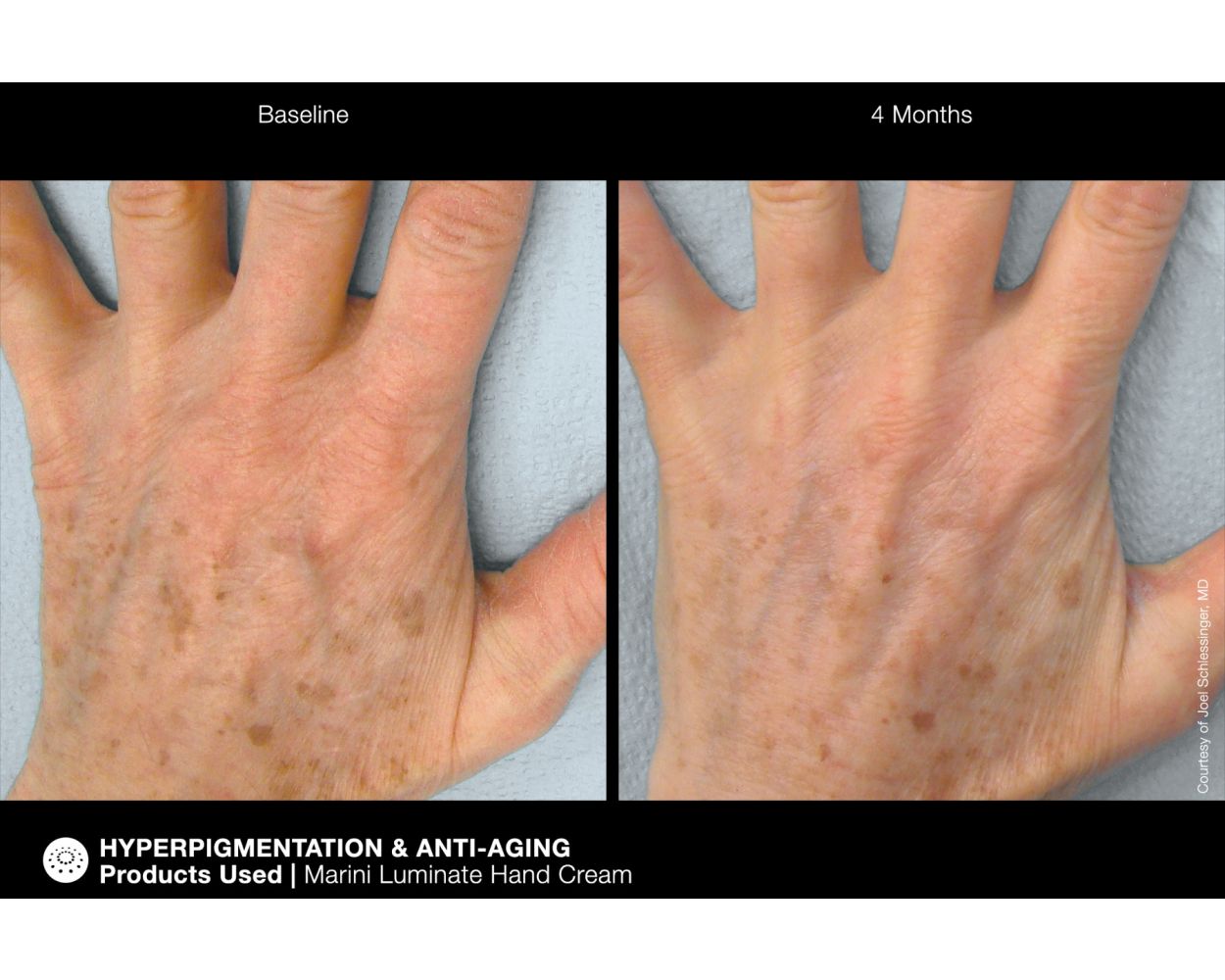 Jan Marini Marini ReNu Corrective Hand Complex - Harben House - Jan Marini