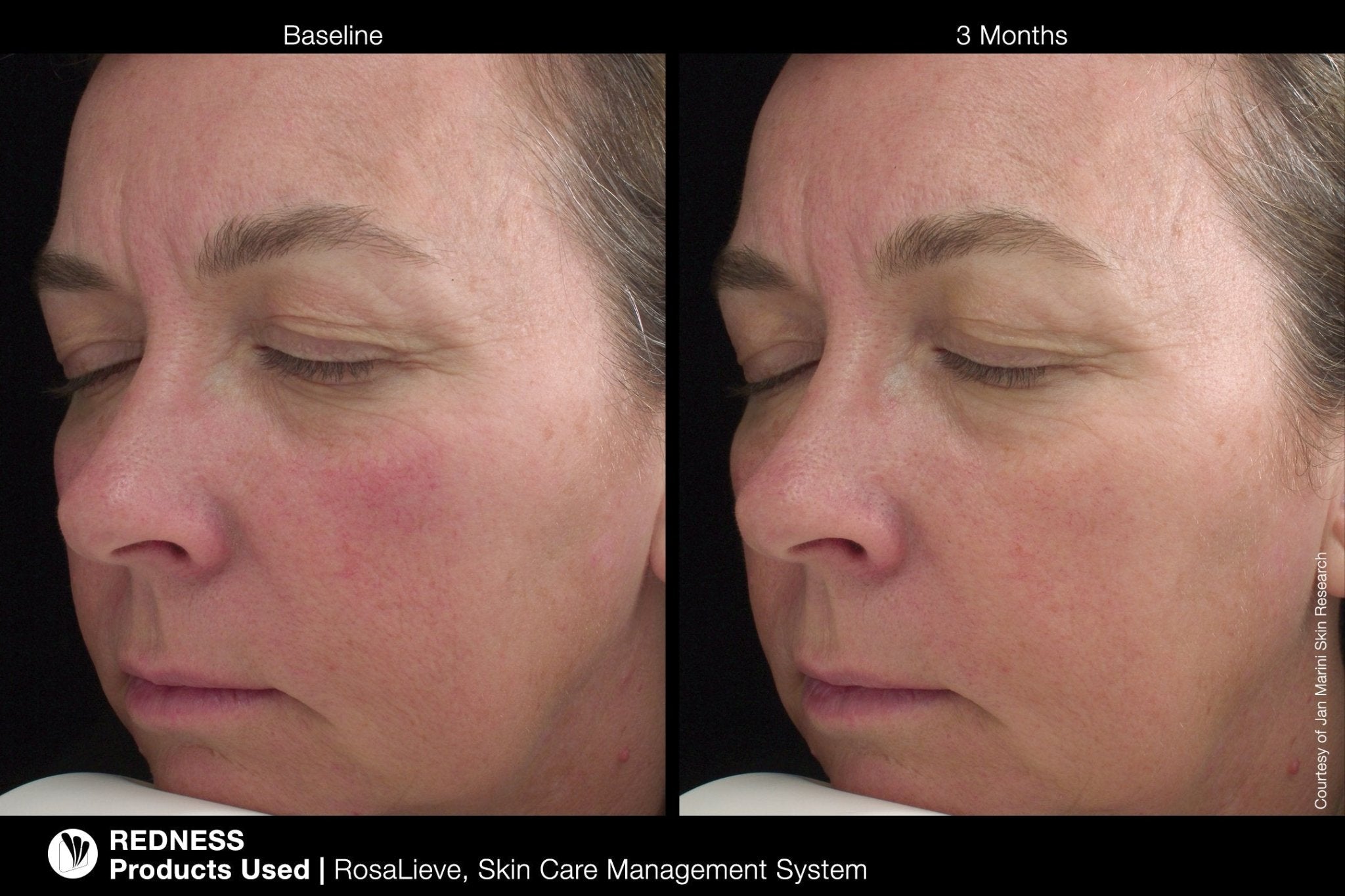 ROSALIEVE Redness Reducing Complex 30ml