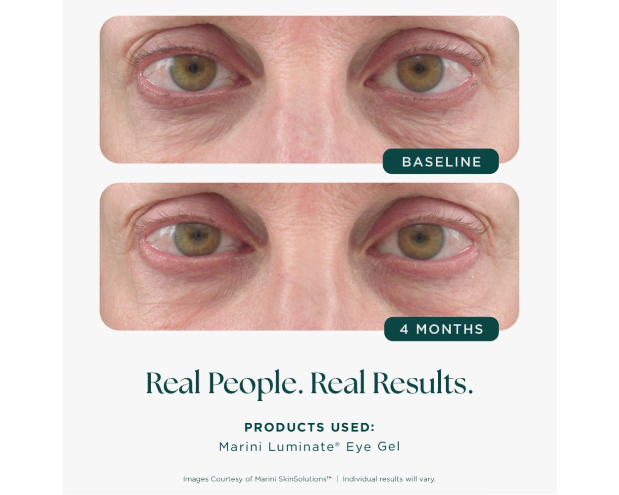 Marini Skin Solutions Marini Luminate Eye Gel