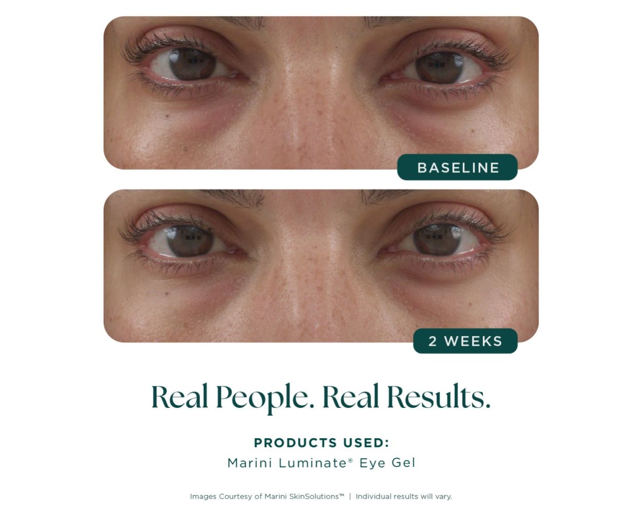 Marini Skin Solutions Marini Luminate Eye Gel