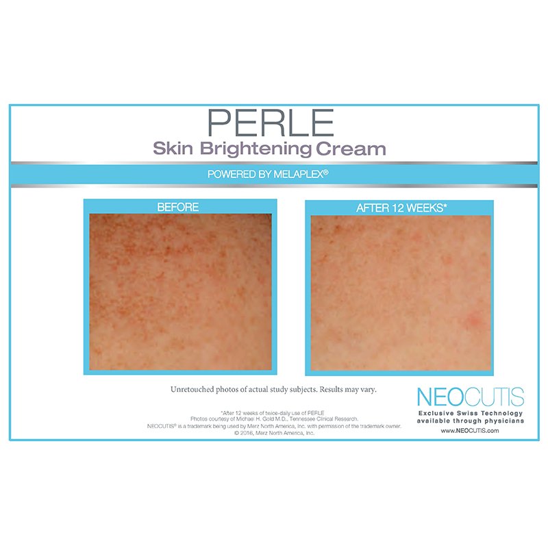 NEOCUTIS Perle Skin Brightening Cream - Harben House - NeoCutis