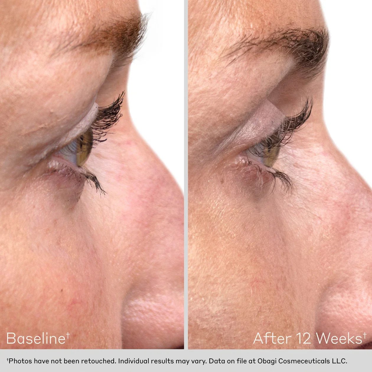 Obagi Nu - Cil Duo Eyelash + Eyebrow Serum - Harben House - Obagi Medical